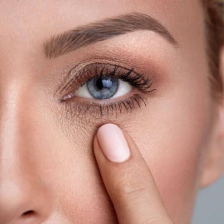 Tratamento para Olheiras